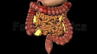 Enfermedad de Crohn Enfermedad inflamatoria intestinal [upl. by Calia]