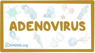 Adenovirus  an Osmosis Preview [upl. by Venetis274]