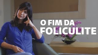 3 dicas infalíveis para evitar a foliculite  Viver Bem [upl. by Anelhtak]