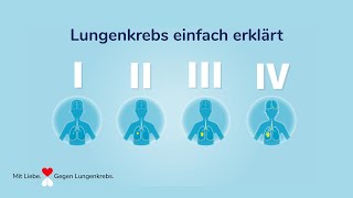 Fortschritte im Kampf gegen Lungenkrebs [upl. by Bainbrudge]