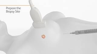 BD EleVation Breast Biopsy Instructional Video [upl. by Jo]