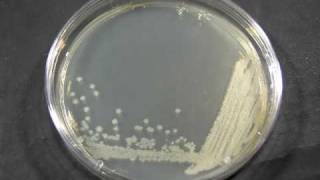 TimeLapse of Bacillus cereus growing [upl. by Raddatz]