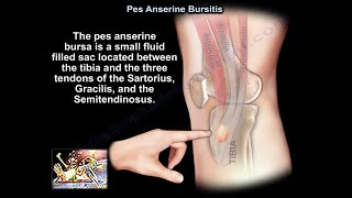 Pes Anserine Bursitis  Everything You Need To Know  Dr Nabil Ebraheim [upl. by Meyer]