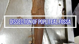 Dissection of Popliteal Fossa [upl. by Larner95]