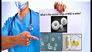 WBC in Urine  High Count Causes [upl. by Oecile]