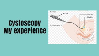 PrimeSight Cystoscopy Central Ohio Urology Group [upl. by Kannry]